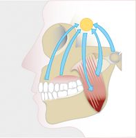 Auswirkungen einer CMD